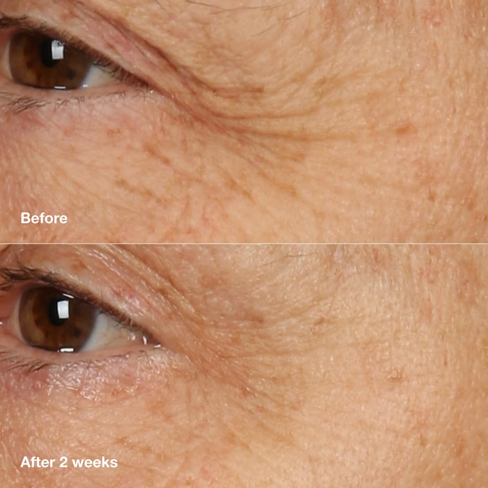 Clinique Smart Clinical Repair Anti Aging Overnight Recovery Face Cream + Mask For All Skin Types | With Hyaluronic Acid + Peptides | Hydrating | Repairs Lines + Wrinkles, 1.7 Fl Oz